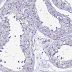 Immunohistochemical staining of human testis shows no positivity in cells in seminiferous ducts as expected.