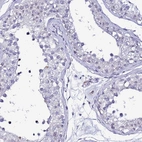 Immunohistochemical staining of human testis shows no positivity in cells in seminiferous ducts as expected.