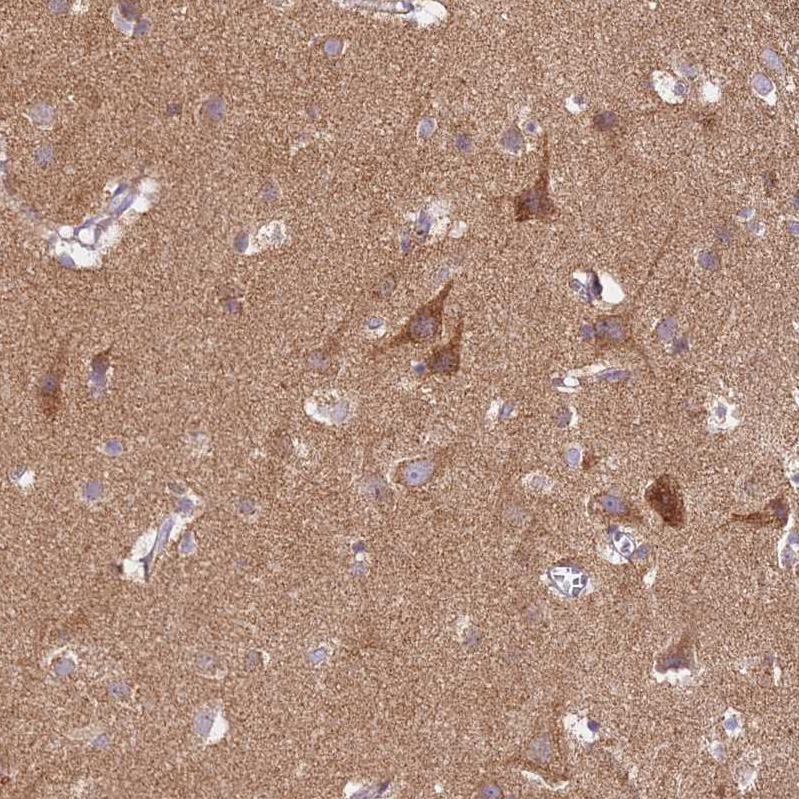 Anti-PROKR2 Antibody