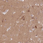 Anti-PROKR2 Antibody