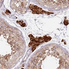 Immunohistochemical staining of human testis shows moderate to strong cytoplasmic positivity in Leydig cells and cells in seminiferous ducts.
