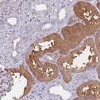 Anti-OR7C2 Antibody