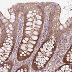 Anti-SOS2 Antibody