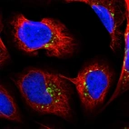 Immunofluorescent staining of human cell line U-2 OS shows localization to the Golgi apparatus & vesicles.