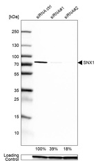 Western blot analysis in U2OS cells transfected with control siRNA, target specific siRNA probe #1 and #2, using Anti-SNX1 antibody. Remaining relative intensity is presented. Loading control: Anti-GAPDH.