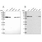 Western blot analysis using Anti-SNX1 antibody HPA047373 (A) shows similar pattern to independent antibody HPA052761 (B).