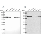 Western blot analysis using Anti-SNX1 antibody HPA047373 (A) shows similar pattern to independent antibody HPA052761 (B).