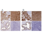 Immunohistochemical staining of human kidney, liver, prostate and tonsil using Anti-HGD antibody HPA047374 (A) shows similar protein distribution across tissues to independent antibody HPA052359 (B).