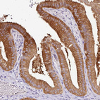 Immunohistochemical staining of human gallbladder shows strong cytoplasmic positivity in glandular cells.