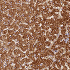 Immunohistochemical staining of human liver shows strong cytoplasmic positivity in hepatocytes.