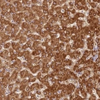 Immunohistochemical staining of human liver shows strong cytoplasmic positivity in hepatocytes.