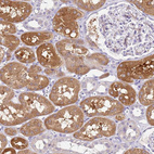 Immunohistochemical staining of human kidney shows strong cytoplasmic positivity in cells in tubules.
