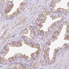 Immunohistochemical staining of human prostate shows moderate cytoplasmic positivity in glandular cells.