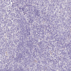 Immunohistochemical staining of human tonsil shows no positivity in non-germinal center cells as expected.