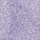 Immunohistochemical staining of human tonsil shows no positivity in non-germinal center cells as expected.