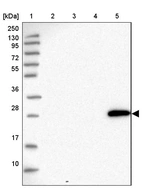 Lane 1: Marker [kDa] 250, 130, 95, 72, 55, 36, 28, 17, 10_br/_Lane 2: Human cell line RT-4_br/_Lane 3: Human cell line U-251MG sp_br/_Lane 4: Human plasma (IgG/HSA depleted)_br/_Lane 5: Human liver tissue