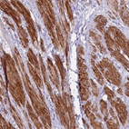 Anti-KBTBD3 Antibody