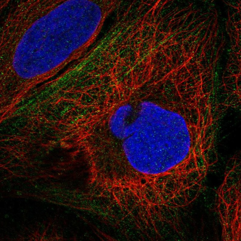 Anti-BPIFB4 Antibody