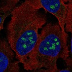 Anti-BLCAP Antibody