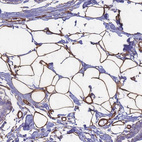 Anti-EHD2 Antibody