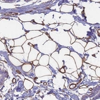 Anti-EHD2 Antibody