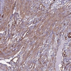 Immunohistochemical staining of human Smooth muscle shows moderate cytoplasmic positivity in smooth muscle cells.