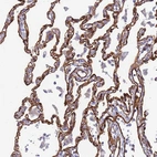 Immunohistochemical staining of human Lung shows strong membranous and cytoplasmic positivity in pneumocytes.