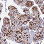 Immunohistochemical staining of human Placenta shows strong membranous and cytoplasmic positivity in endothelial cells.
