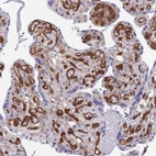 Immunohistochemical staining of human Placenta shows strong membranous and cytoplasmic positivity in endothelial cells.