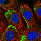 Immunofluorescent staining of human cell line A-431 shows localization to plasma membrane.
