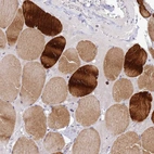 Anti-CXorf65 Antibody