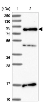 Lane 1: Marker [kDa] 250, 130, 95, 72, 55, 36, 28, 17, 10_br/_Lane 2: Human cell line RT-4