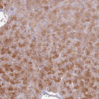 Immunohistochemical staining of human pancreas shows moderate cytoplasmic positivity in exocrine glandular cells.