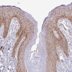 Immunohistochemical staining of human skin shows weak to moderate cytoplasmic positivity in squamous epithelial cells.