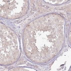 Immunohistochemical staining of human testis shows weak cytoplasmic positivity in cells in seminiferous ducts.