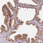 Anti-PHC2 Antibody