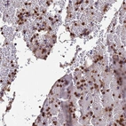 Anti-AMPD3 Antibody