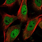 Immunofluorescent staining of human cell line U-251 MG shows localization to nucleoplasm.