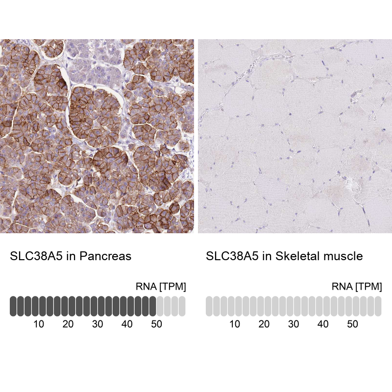 Anti-SLC38A5 Antibody