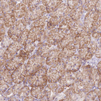 Immunohistochemical staining of human Stomach shows moderate membranous positivity in glandular cells.