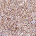 Immunohistochemical staining of human Stomach shows moderate membranous positivity in glandular cells.
