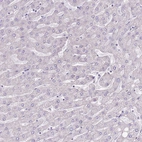 Immunohistochemical staining of human Liver shows no positivity in hepatocytes as expected.