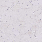 Immunohistochemical staining of human Skeletal muscle shows no positivity in myocytes as expected.