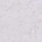Immunohistochemical staining of human Skeletal muscle shows no positivity in myocytes as expected.