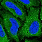 Immunofluorescent staining of human cell line HeLa shows localization to plasma membrane, cytosol & vesicles.