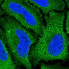 Immunofluorescent staining of human cell line HeLa shows localization to plasma membrane, cytosol & vesicles.