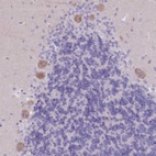 Anti-PIGM Antibody
