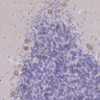 Anti-PIGM Antibody