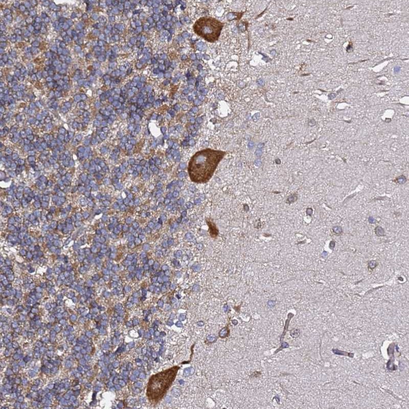 Anti-TPST1 Antibody
