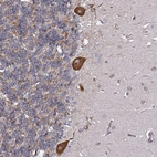 Anti-TPST1 Antibody